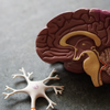 Neurologie und Schlaganfall nach Behandlungsfehlern: Ursachen, Folgen und Schadensersatzansprüche
